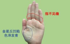 <b>手相图解事业线即使亿万家财，也无福消受的手</b>