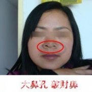 什么是破财鼻，破财鼻的影响及破解方法