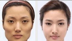 颧骨过高的女人是否克夫?