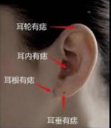 耳朵十大福气痣全解：位置·寓意·实操布局