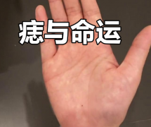 手臂內側有痣代表什麼