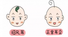 招风耳面相全解析：苏民峰谈